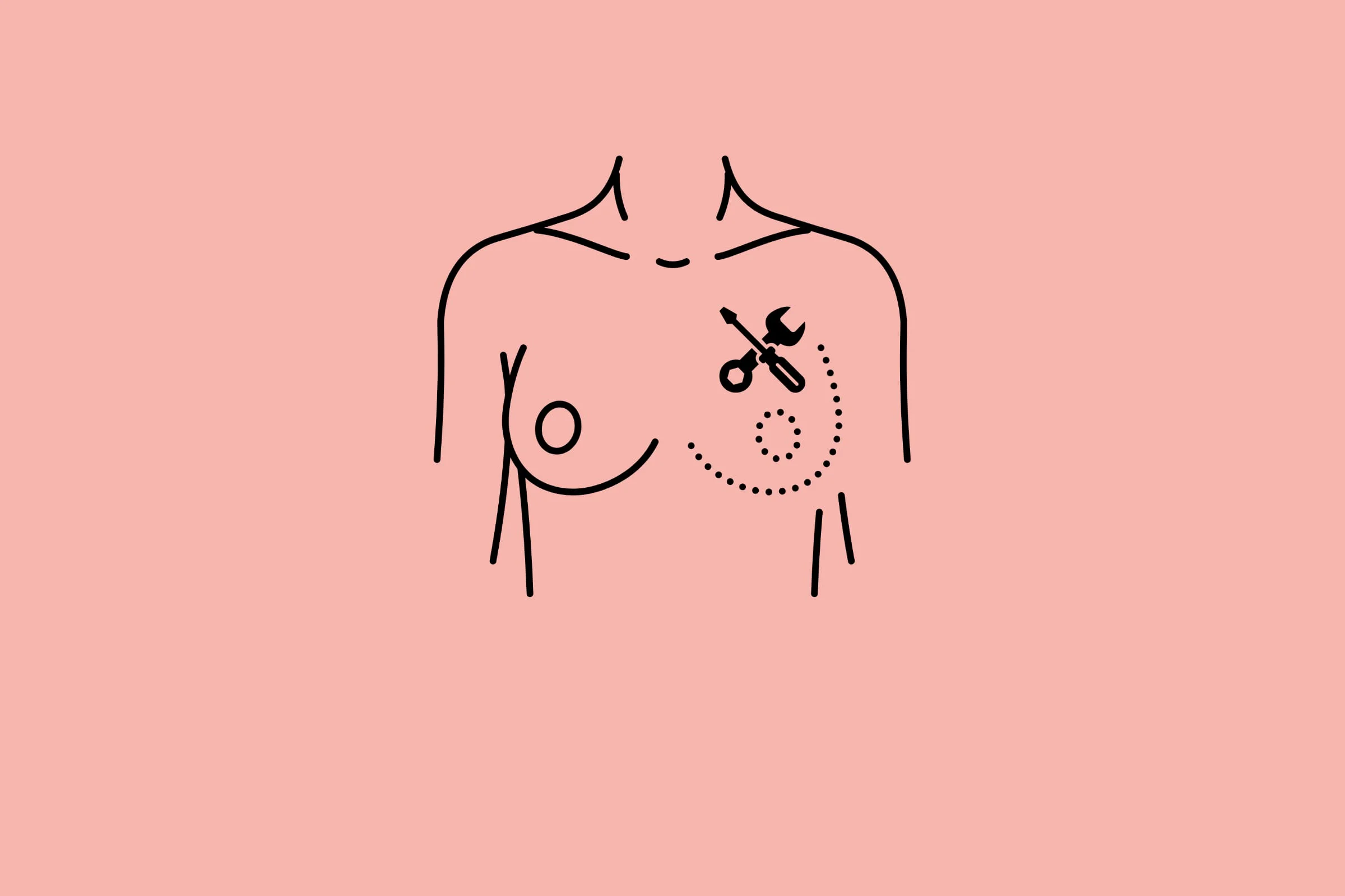Breast Cancer Surgery